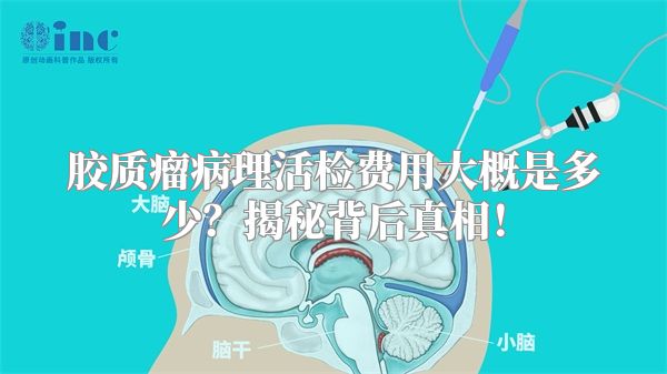 胶质瘤病理活检费用大概是多少？揭秘背后真相！