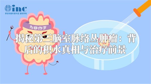 揭秘第三脑室脉络丛肿瘤：背后的积水真相与治疗前景