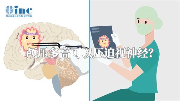 颅压多高可以压迫视神经？