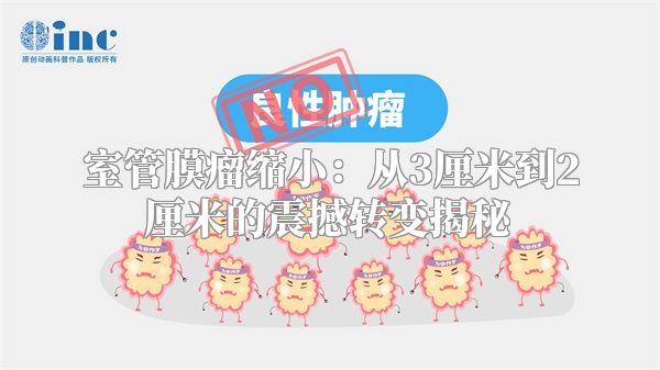 室管膜瘤缩小：从3厘米到2厘米的震撼转变揭秘
