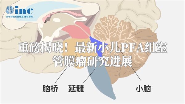 重磅揭晓！最新小儿PFA组室管膜瘤研究进展