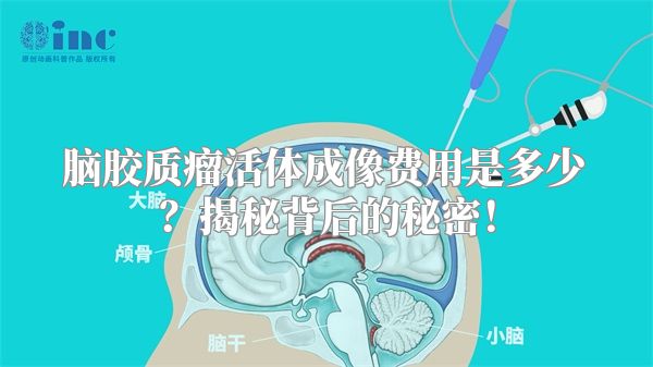 脑胶质瘤活体成像费用是多少？揭秘背后的秘密！