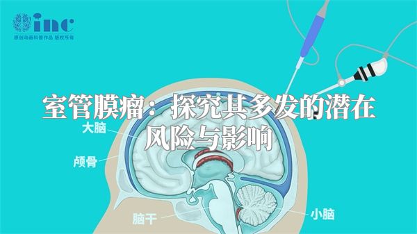 室管膜瘤：探究其多发的潜在风险与影响