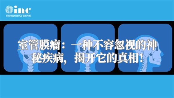 室管膜瘤：一种不容忽视的神秘疾病，揭开它的真相！