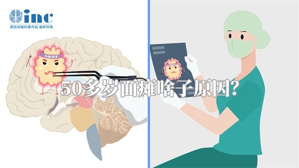50多岁面瘫啥子原因？