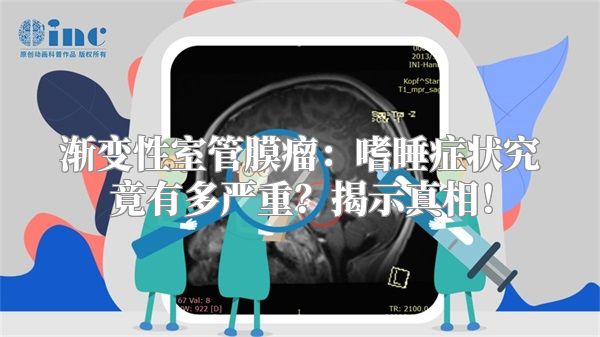 渐变性室管膜瘤：嗜睡症状究竟有多严重？揭示真相！