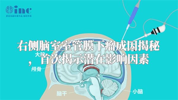 右侧脑室室管膜下瘤成因揭秘，首次揭示潜在影响因素