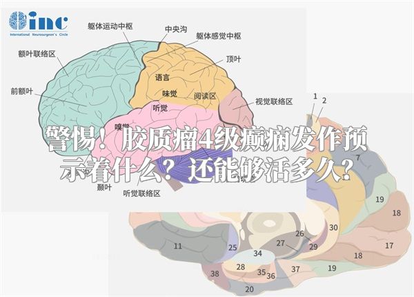 警惕！胶质瘤4级癫痫发作预示着什么？还能够活多久？