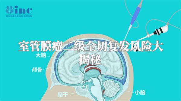 室管膜瘤二级全切复发风险大揭秘