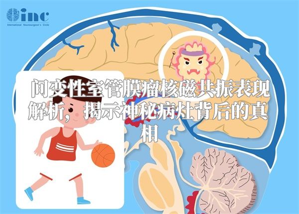 间变性室管膜瘤核磁共振表现解析，揭示神秘病灶背后的真相