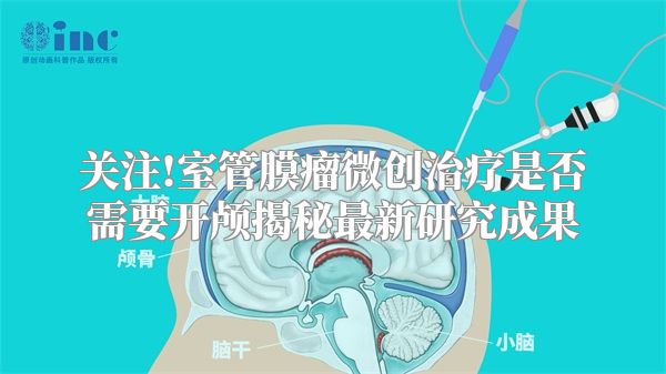 关注!室管膜瘤微创治疗是否需要开颅揭秘最新研究成果