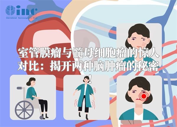 室管膜瘤与髓母细胞瘤的惊人对比：揭开两种脑肿瘤的秘密！