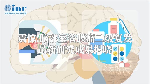 震惊!脑部室管膜瘤二级复发最新研究成果揭晓
