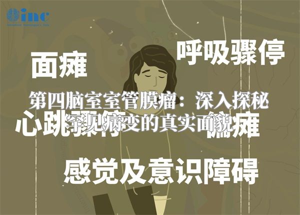 第四脑室室管膜瘤：深入探秘罕见病变的真实面貌
