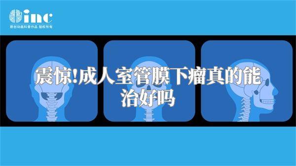 震惊!成人室管膜下瘤真的能治好吗