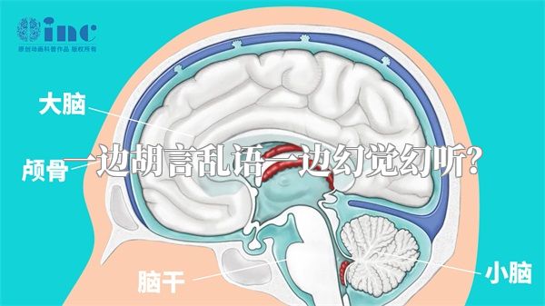 一边胡言乱语一边幻觉幻听？
