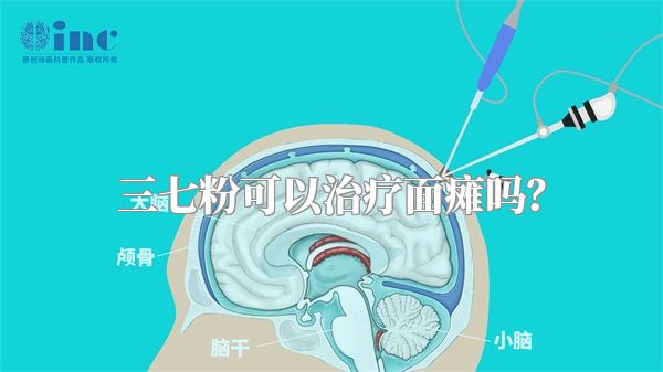 三七粉可以治疗面瘫吗？