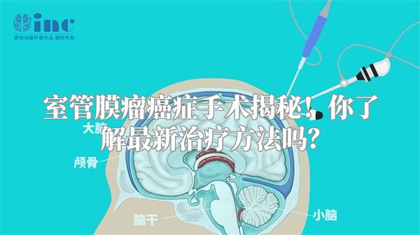 室管膜瘤癌症手术揭秘！你了解最新治疗方法吗？