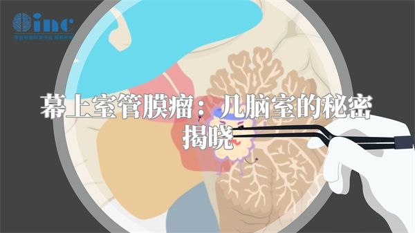 幕上室管膜瘤：几脑室的秘密揭晓
