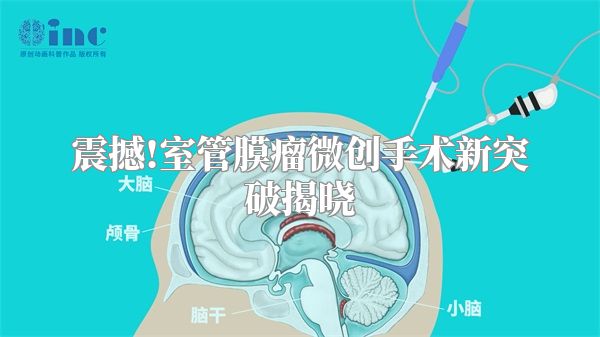 震撼!室管膜瘤微创手术新突破揭晓