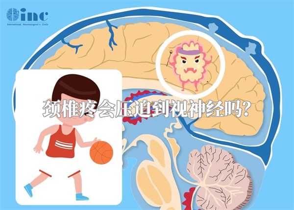 颈椎疼会压迫到视神经吗?