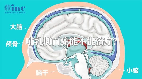 哺乳期面瘫能不能治疗？
