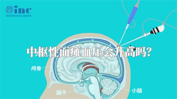 中枢性面瘫血压会升高吗？
