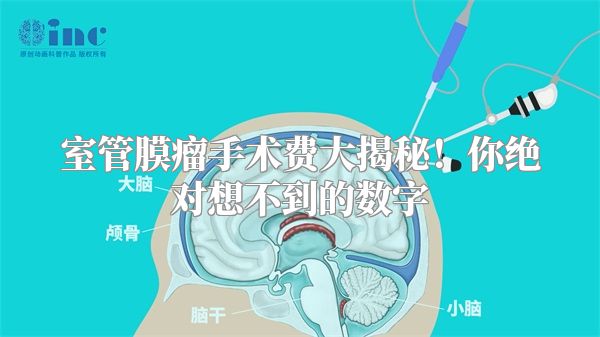 室管膜瘤手术费大揭秘！你绝对想不到的数字