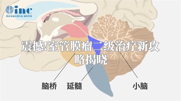 震撼!室管膜瘤二级治疗新攻略揭晓