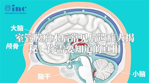 室管膜瘤术后常见后遗症大揭秘：你需要知道的真相