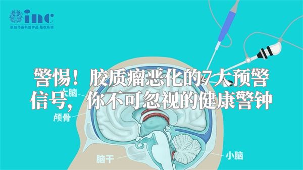 警惕！胶质瘤恶化的7大预警信号，你不可忽视的健康警钟