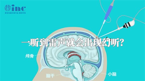 一听到雷声就会出现幻听？