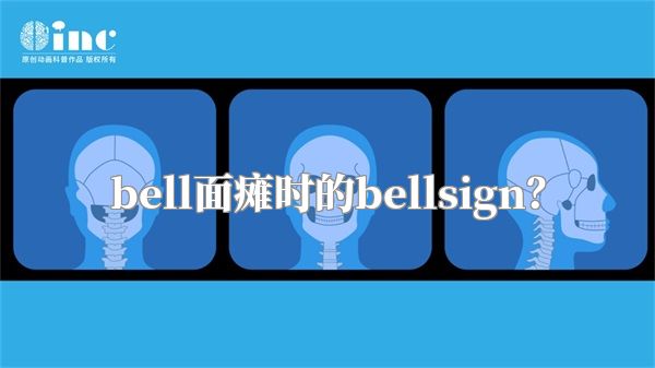 bell面瘫时的bellsign？