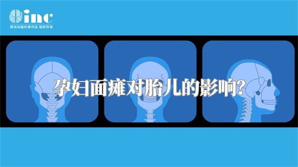 孕妇面瘫对胎儿的影响？