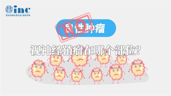 视神经鞘瘤在哪个部位？