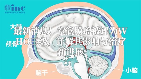 最新消息！室管膜瘤被评为WHO三级，详解其影响与治疗新进展