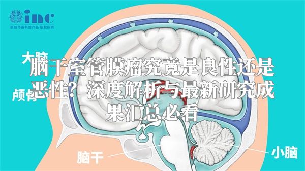 脑干室管膜瘤究竟是良性还是恶性？深度解析与最新研究成果汇总必看