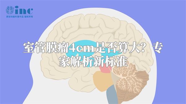室管膜瘤4cm是否算大？专家解析新标准