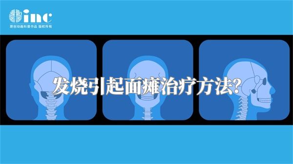 发烧引起面瘫治疗方法？