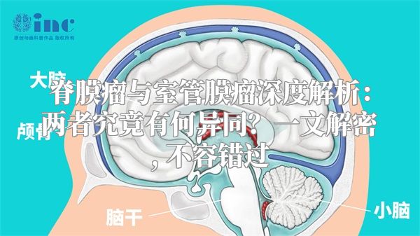脊膜瘤与室管膜瘤深度解析：两者究竟有何异同？一文解密, 不容错过