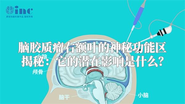 脑胶质瘤右额叶的神秘功能区揭秘：它的潜在影响是什么？