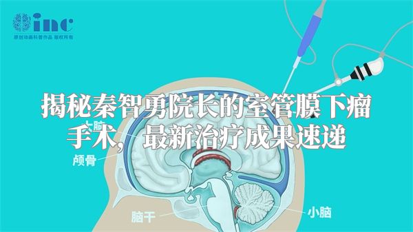 揭秘秦智勇院长的室管膜下瘤手术，最新治疗成果速递
