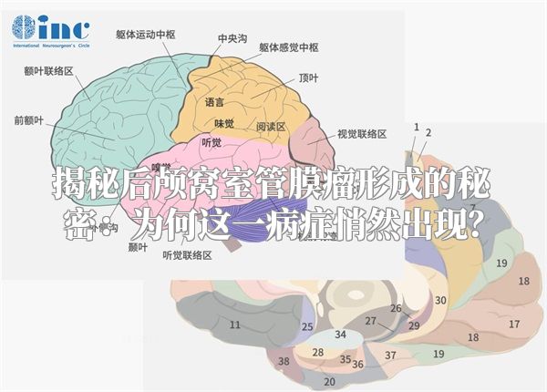 揭秘后颅窝室管膜瘤形成的秘密：为何这一病症悄然出现？
