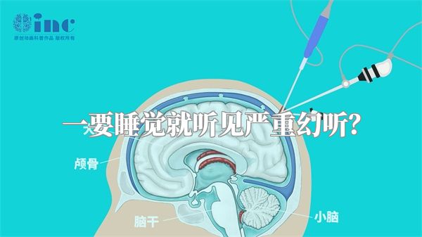 一要睡觉就听见严重幻听？