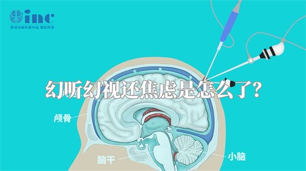 幻听幻视还焦虑是怎么了？