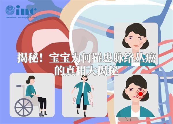 揭秘！宝宝为何罹患脉络丛癌的真相大揭秘
