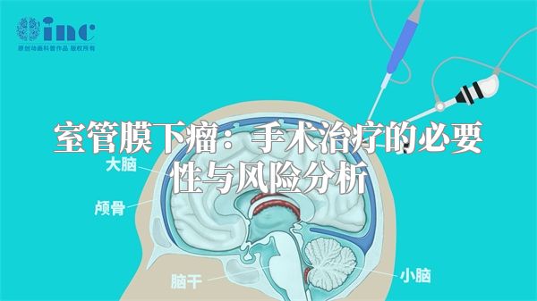 室管膜下瘤：手术治疗的必要性与风险分析