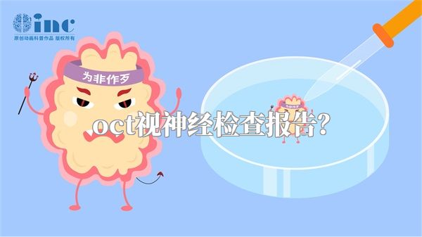 oct视神经检查报告？