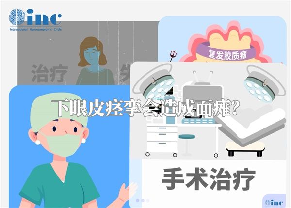 下眼皮痉挛会造成面瘫？