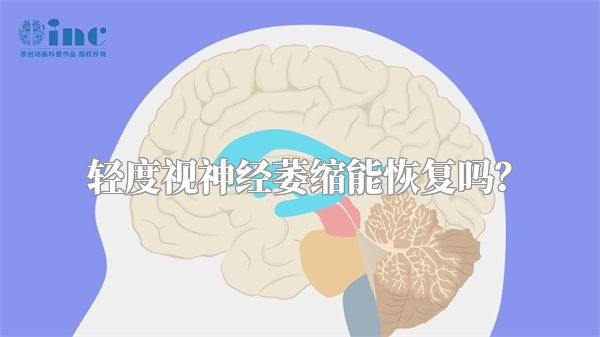 轻度视神经萎缩能恢复吗？